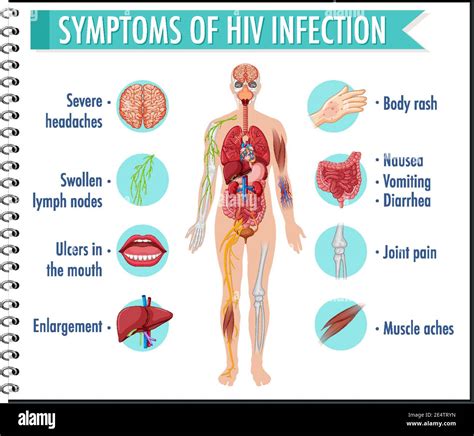 Symptoms Of Hiv Infection Infographic Illustration Stock Vector Image And Art Alamy