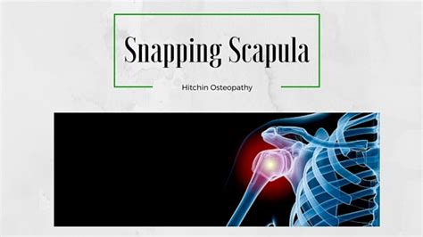 The purpose of this review is to discuss the anatomy of the scapulothoracic articulation with an emphasis on the pathology associated with snapping scapula. Snapping Scapula Syndrome| Hitchin Osteopathy
