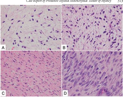 Figure 3 From A Cooperative Approach To Diagnosis Of Rare Diseases