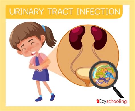 Increasing Risk Of Urinary Tract Infection In Kids