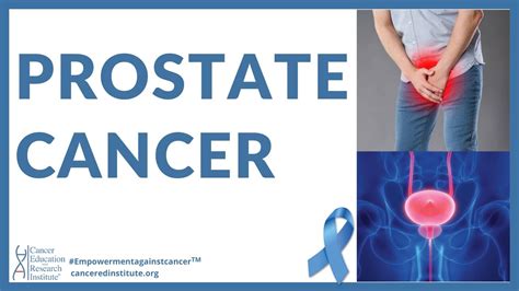 What Are The First Signs Of Prostate Cancer Prostate Cancer Symptoms