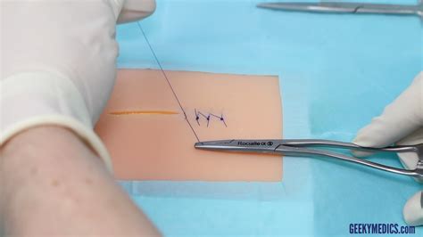 Simple Interrupted Suture Osce Guide Wound Suturing Geeky Medics