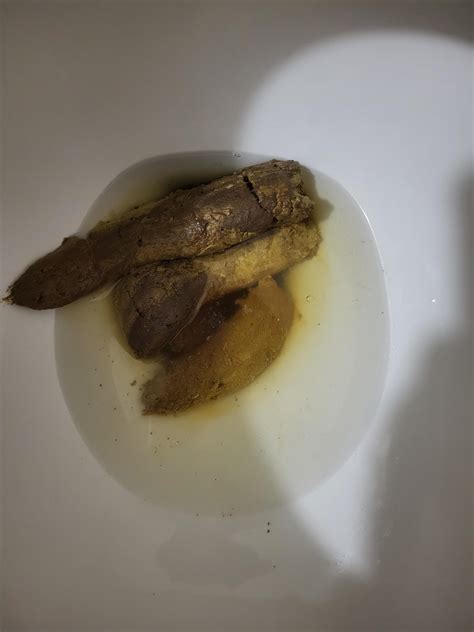 Whats Wrong With My Poop Rpoop