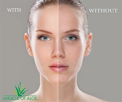 Why Choose Miracle Of Aloe Dull Skin Skin Uneven Skin