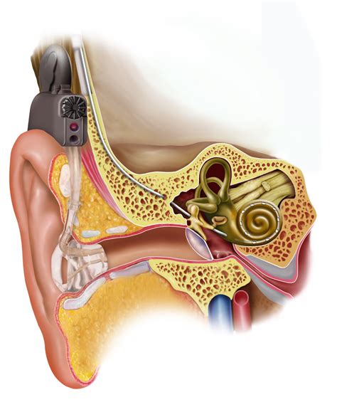 The camel has small ears covered with thick hair from all sides to protect them from flying desert dust. Electric acoustic stimulation - Wikipedia