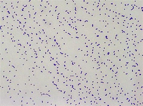 Streptococcus Pneumoniae Gram Stain Streptococcus Pneumoniae In Sputum Stock Image B