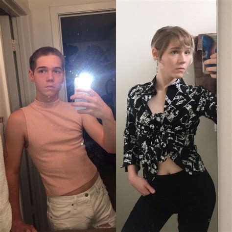 Now With More Hip Mtf Age 20 11 Months Hrt Transtimelines Tg