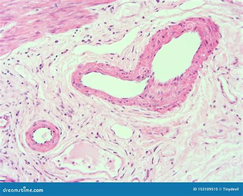 Histologie De Tissu Humain De Vésicule Biliaire Image Stock Image Du