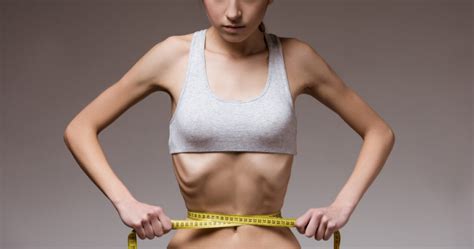 Anorexia Nervosa Causes Symptoms And Treatment 【 2024