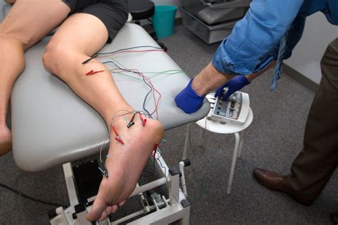 how effective is physical therapy dry needling with electrical stimulation — mend