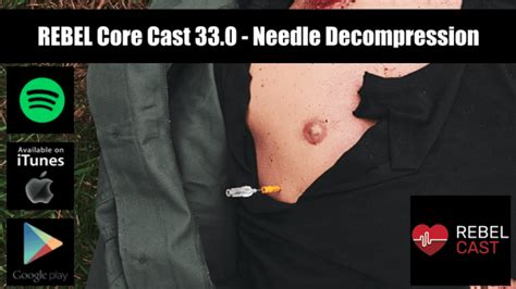 Rebel Core Cast 330 Needle Decompression Rebel Em Emergency