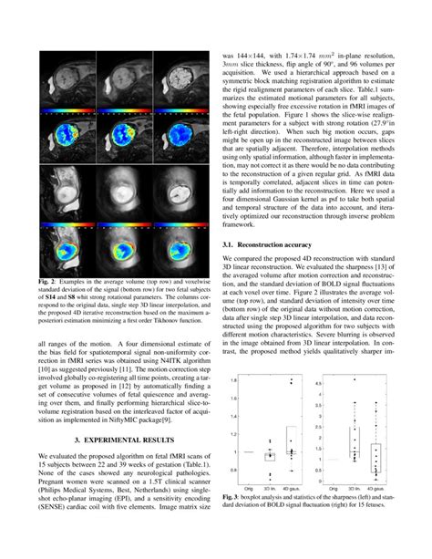 4d Iterative Reconstruction Of Brain Fmri In The Moving Fetus Deepai