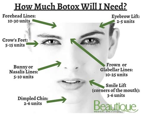 We Get Lots Of Questions About How Much Botox Is Needed For Different