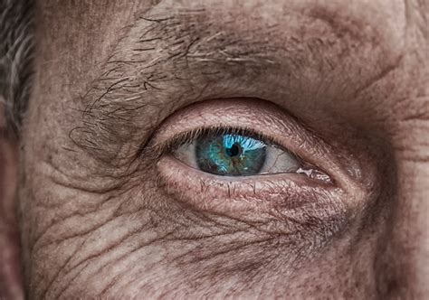 What Are The 3 Types Of Cataracts Three Types Of Cataracts Harvard Eye