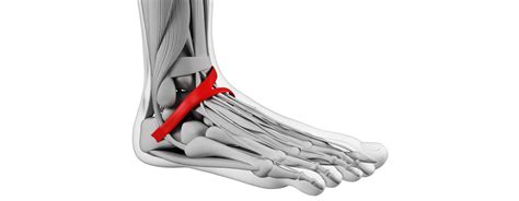 Treatments For Tarsal Coalition Orange County Foot And Ankle Doctor