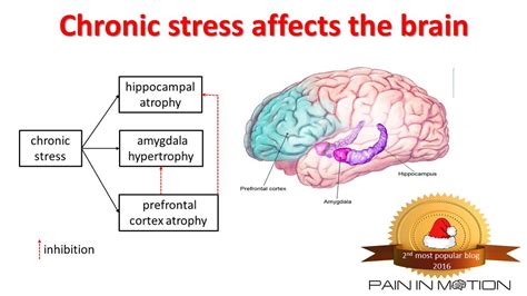 Effects Of Stress On The Brain Chronic Stress Effects Of Stress My