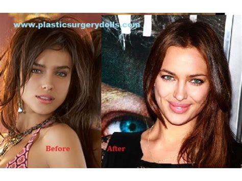 Irina promoted herself as latin model in fashion business because there is high demand for latin models. Google | Lip surgery, Plastic surgery, Irina shayk