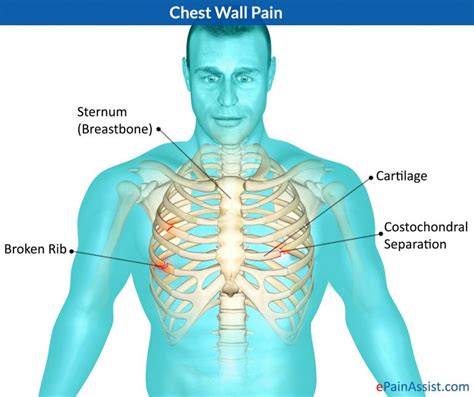 Teaching Points In Medicine An Elaborate And Unnecessary Chest Pain