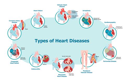 Common Types Of Heart Disease Facty Health - vrogue.co