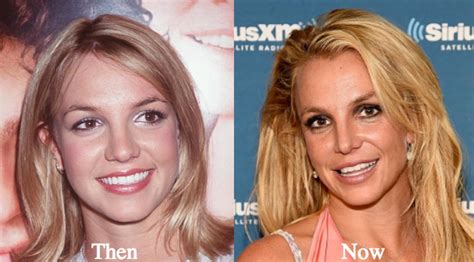 Britney Spears Face Then And Now