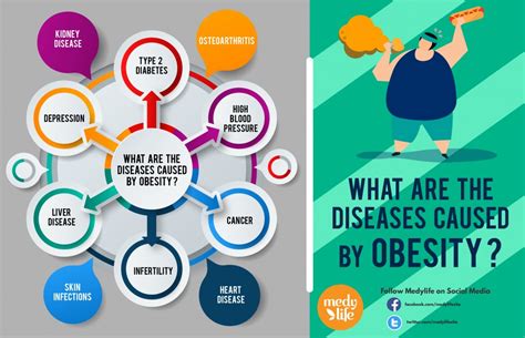 Obesity Why It Happens And The Best Ways To Overcome It Medy Life