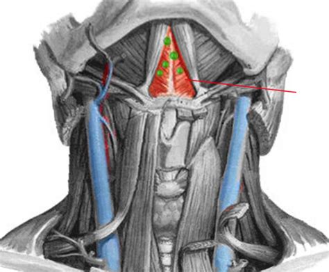 Anatomy Head And Neck Submental Triangle Article Statpearls