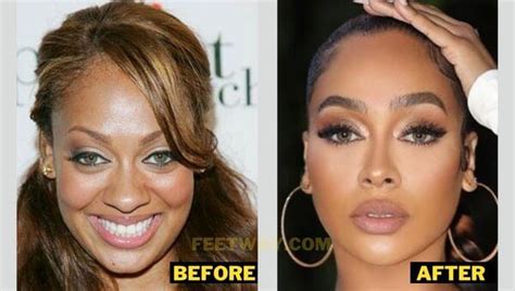 Lala Anthony Plastic Surgery Details With Before And After Pictures