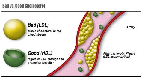 Ako Znížiť Cholesterol Strava Lieky Alebo Domáce Recepty