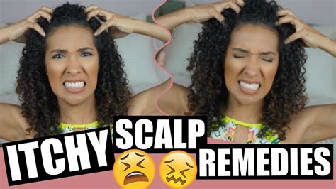 How To Treat An Itchy Scalp Risasrizos Youtube