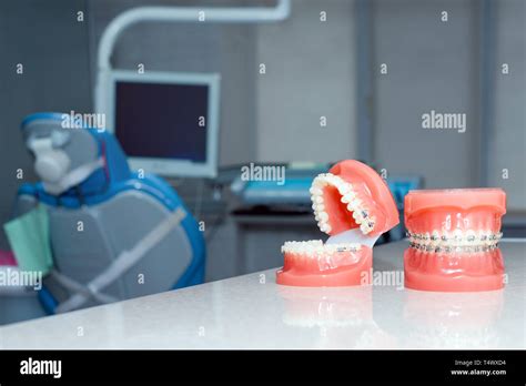 Orthodontic Model And Dentist Tool Demonstration Teeth Model Of