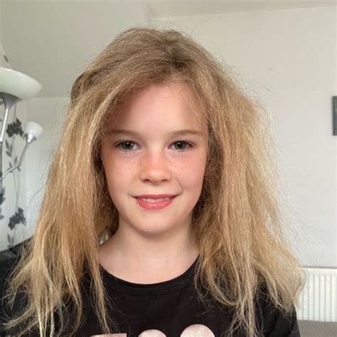 Uncombable Hair Syndrome The Worlds Cutest Medical Condition Page 1 Ar15com