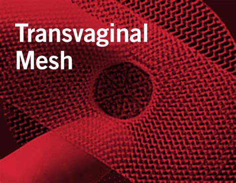 Transvaginal Mesh Study Reports Continued Incontinence Problem