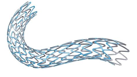 Vici Venous Stent System Demonstrates Positive Clinical Outcomes In