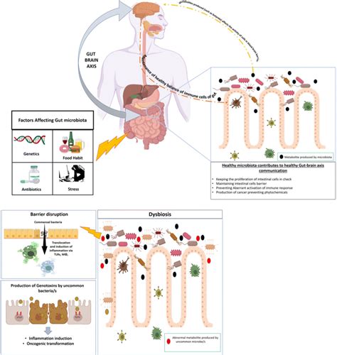 Schematic Representation Of Gut Microbiome In Crc Development