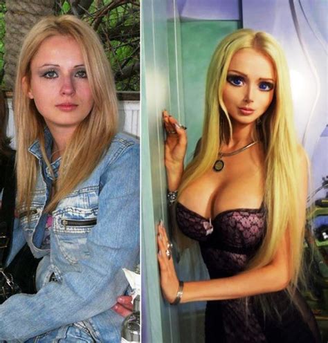 Barbie Plastic Surgery Girl Before And After Pictures Plastic Surgery Before And After