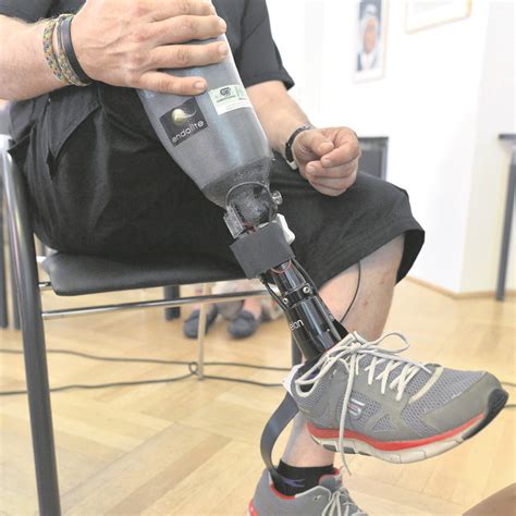 Worlds First ‘feeling Prosthetic Leg Offers New Hope To Amputees