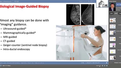 Breast Biopsy Youtube