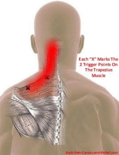 How To Release A Trapped Nerve In Shoulder Blade