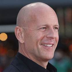 Pin On Bold And Bald Celebrities