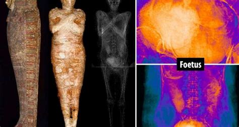 Worlds First Pregnant Ancient Egyptian Mummy Identified By Scientists After X Ray Scans Of