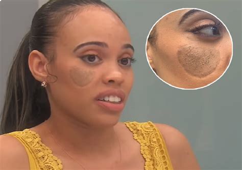 Heres Why This Lady Is Having Pubic Hair Grow On Her Face Face2face Africa