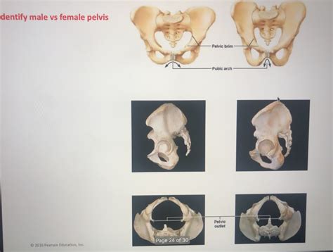 Male Vs Female Pelvis Diagram Quizlet