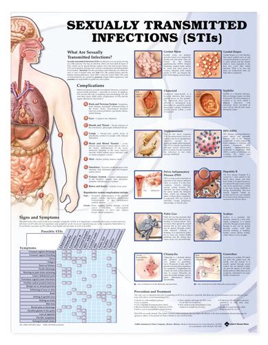 Sexually Transmitted Infections Stis Chart Sexual Health Poster