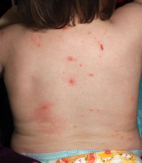 What Is That Rash Adc Education And Practice Edition