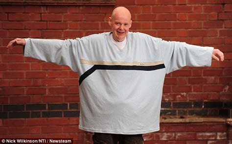 morbidly obese man loses more than 17 stone in one year after doctors warned he was days from