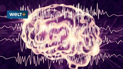 Gewitter Im Gehirn Was Bei Epilepsie Passiert Und Was Dagegen Helfen