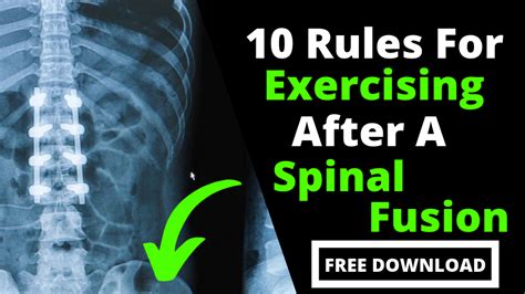 Top 10 Core Exercises Safe For Spinal Fusions Fitness 4 Back Pain