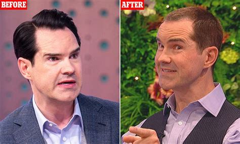 — jimmy carr (@jimmycarr) august 18, 2021. Jimmy Carr reveals he's had a HAIR TRANSPLANT as he shows ...