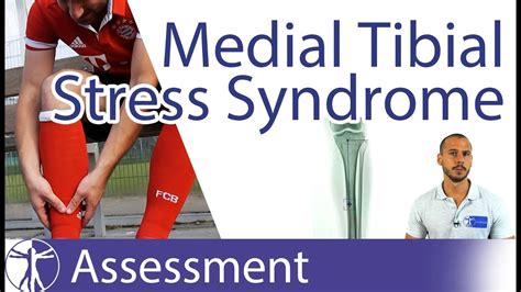Medial Tibial Stress Syndrome Mtss Shin Splints Youtube