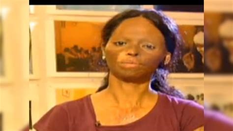 acid attack victim laxmi to receive international women of courage award firstpost
